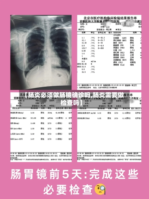 【肠炎必须做肠镜确诊吗,肠炎需要做检查吗】-第3张图片