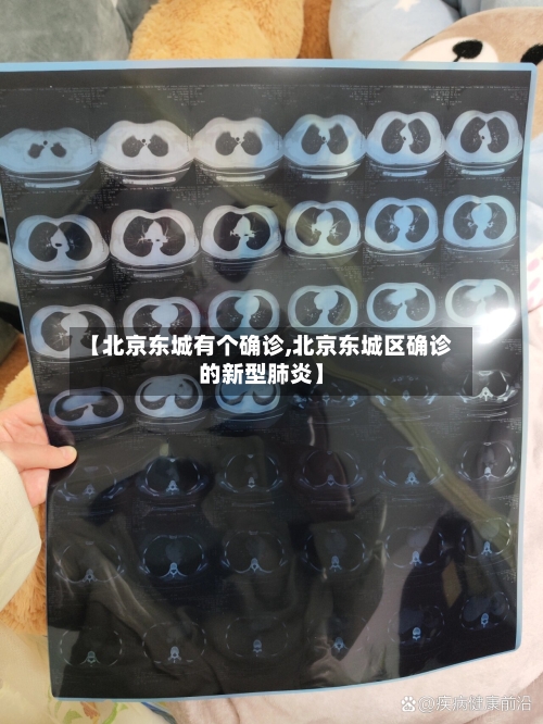 【北京东城有个确诊,北京东城区确诊的新型肺炎】-第2张图片