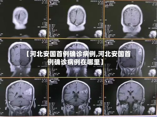 【河北安国首例确诊病例,河北安国首例确诊病例在哪里】-第1张图片
