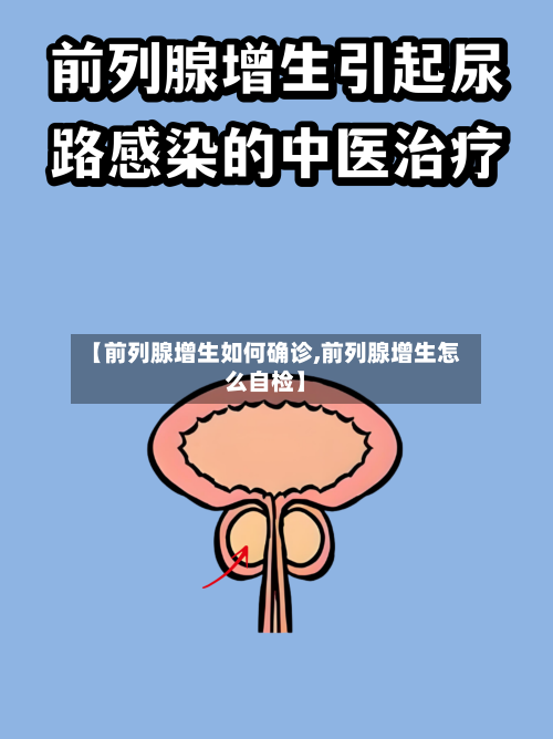 【前列腺增生如何确诊,前列腺增生怎么自检】-第2张图片