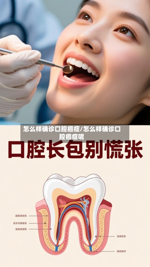 怎么样确诊口腔癌症/怎么样确诊口腔癌症呢-第3张图片